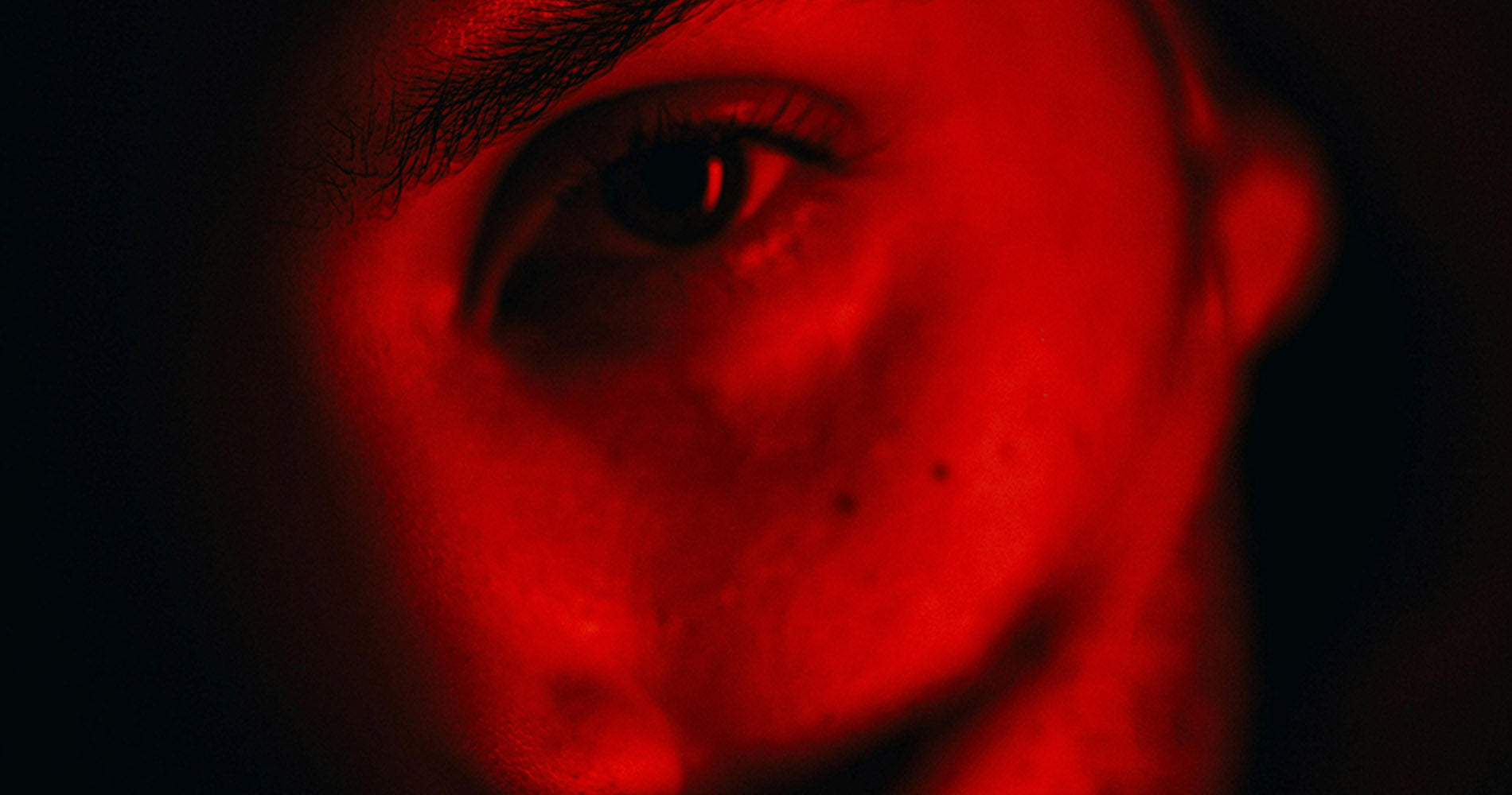 Facial Sensitivity: An Expression of Underlying Imbalance